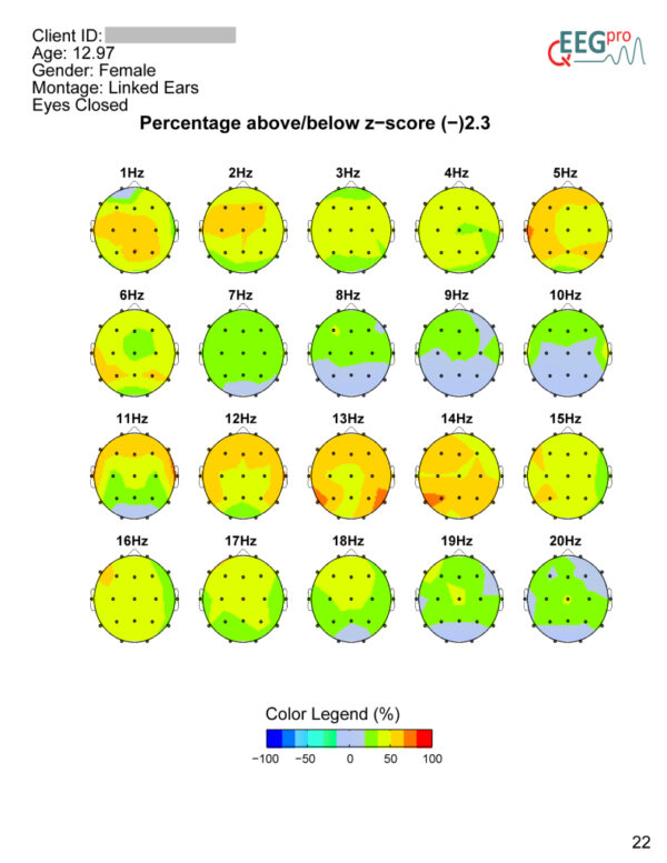 percentage above - below z-score